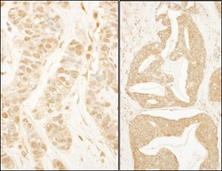 BTF3 Antibody, Novus Biologicals 0.1mg; Unlabeled:Antibodies, Polyclonal